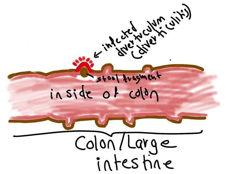 Blogimage2