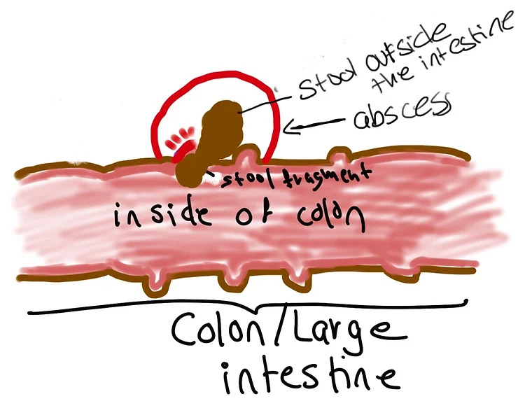 Blogimage3